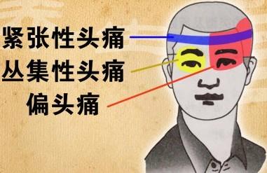 右侧头痛连带右侧鼻子,右半边头痛是什么原因怎么缓解