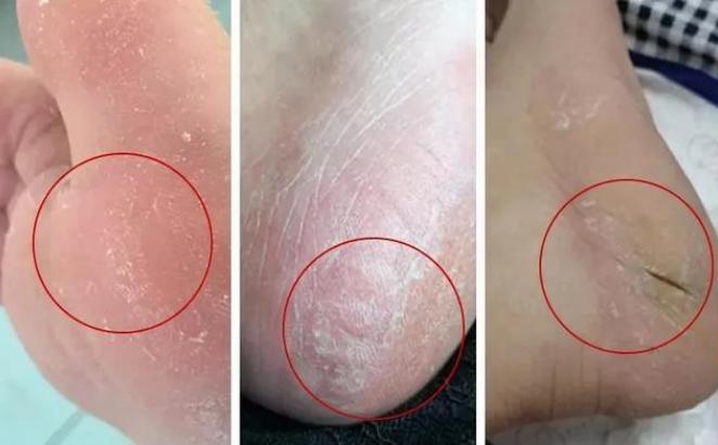 郑恺李佳琦,郑恺同款贴纸