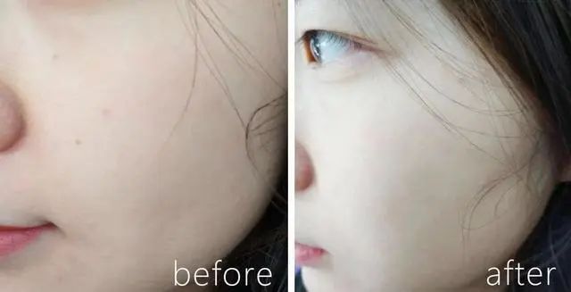 婴儿肌是怎么保养的,婴儿睡觉是身体在自我修复吗