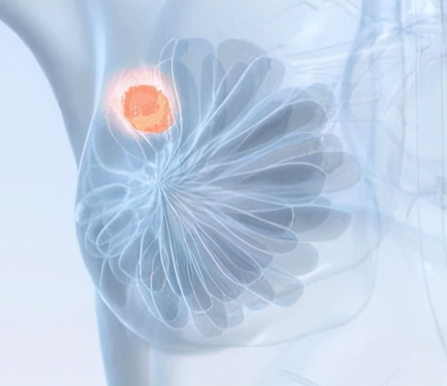 右乳低回声进一步检查什么,右乳低回声区内回声不均