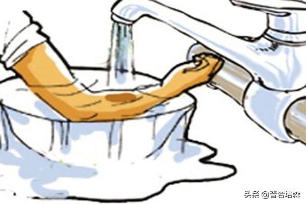 手烫伤了怎么办小妙招视频,如被烫伤或烧伤急救措施应怎样做