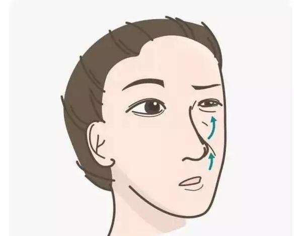 脸上有法令纹去除最好的方法,一般情况最早多大年龄出现法令纹