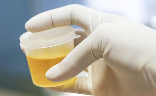 肾病好不好治疗,肾病严重不严重看肾小球滤过率吗