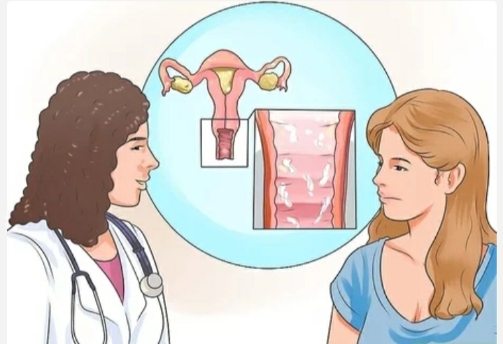 阴道松弛症,凯格尔训练无效怎么办?