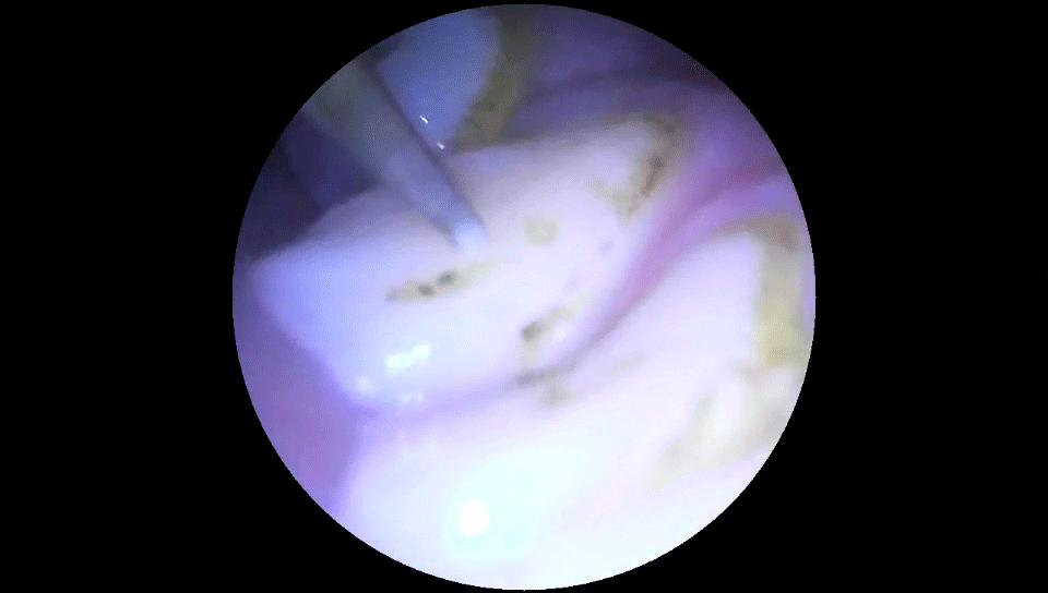 全球首款可视超声波洁牙仪,小米有品众筹已上线,仅199元