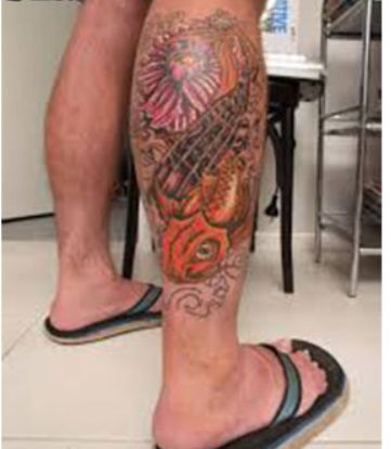 紧急！全澳多地出现“吃人菌”，感染后如同丧尸！24小时可吃一人