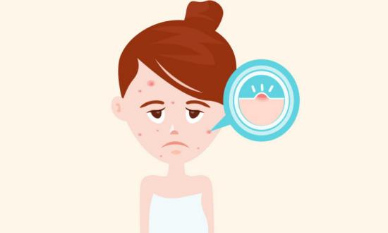 长痘就真的不能化妆了吗,脸上长痘不能化妆吗