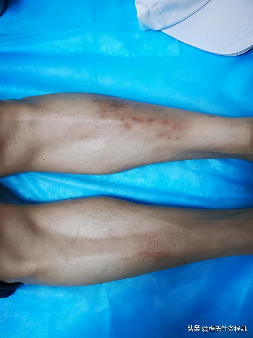 程凯养生说腿上的经络,程凯养生说脏腑推拿