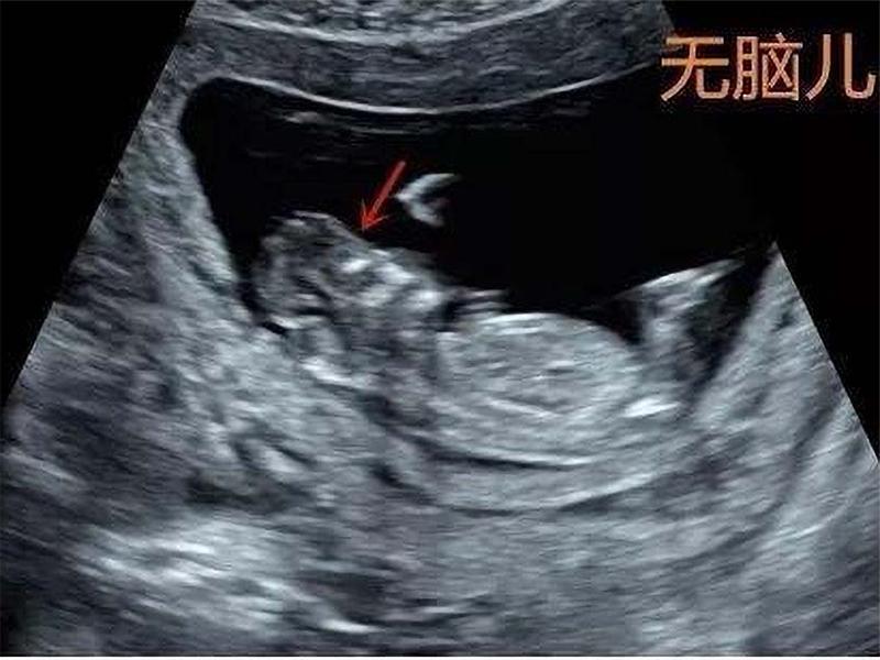 一个刚孕妈妈应该怎么备孕最好,如何备孕成功生孩子