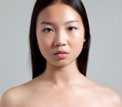 娲昏鍖栫榾鐨勪腑鎴愯嵂鍙互娣″寲鏂戠偣,娲昏鍖栫榾鍏婚鑽湁鍝簺