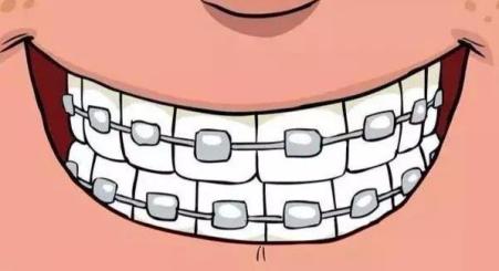 深圳正畸科医生口碑,正畸托槽掉了去诊所要收费吗