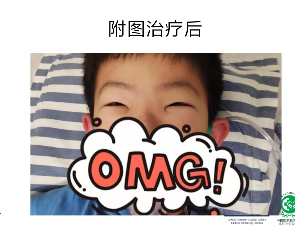 甲醛中毒引起的皮肤过敏怎么办,甲醛引起皮肤过敏用什么治疗