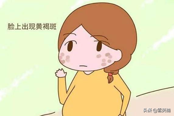 褐斑怎么去除最快最有效,褐斑用什么去除效果最好