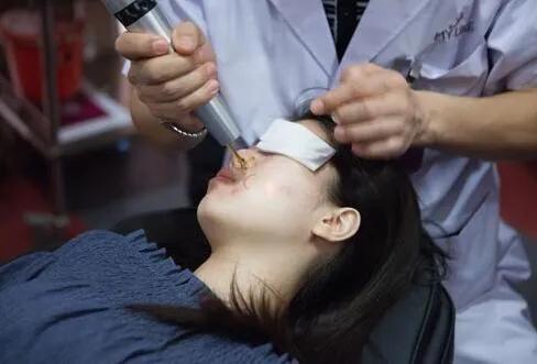 超皮秒激光褐青斑要注意什么,皮秒去除太田痣和激光去除的区别