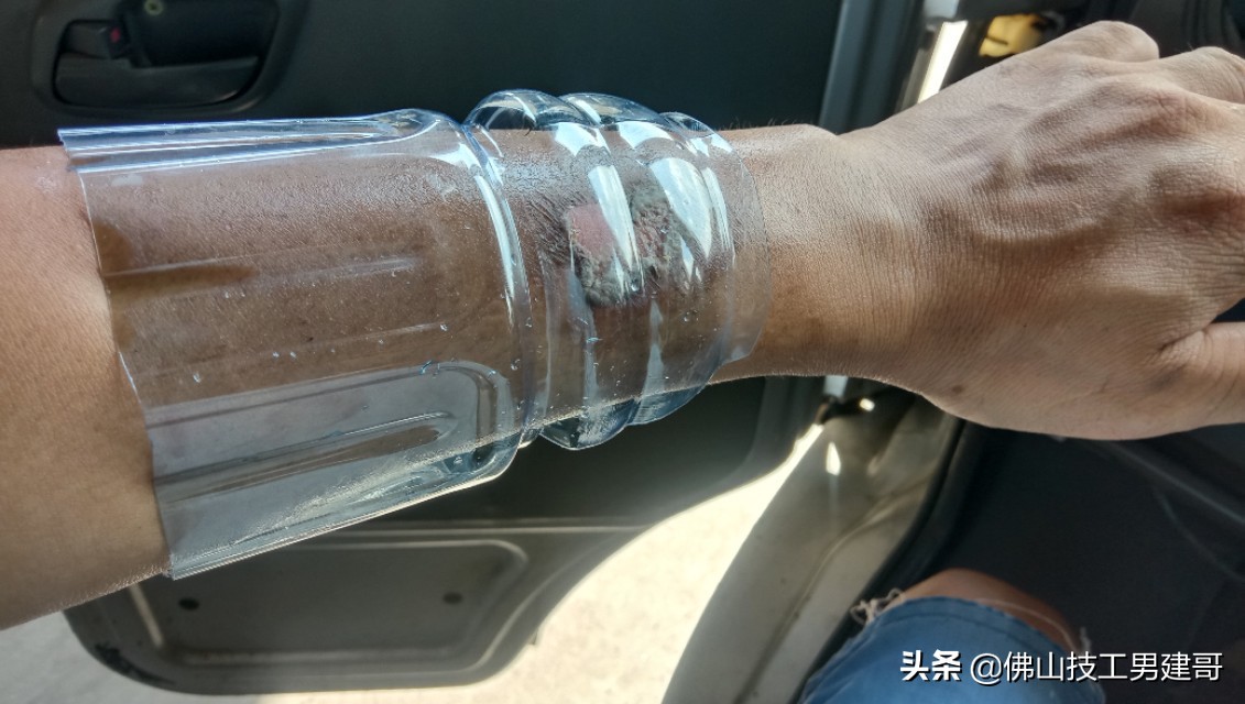 手部烫伤后的康复视频,手烫伤处理视频