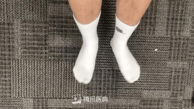 帅气小伙脚臭,25岁男人脚臭