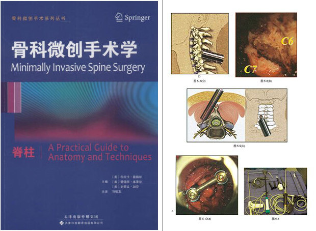 微创手术和传统手术的区别,微创手术与传统手术的区别有哪些