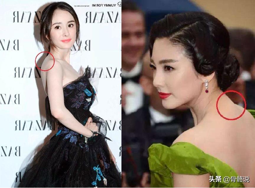 怎么预防脖子有个富贵包,脖子后的富贵包真是夺命包