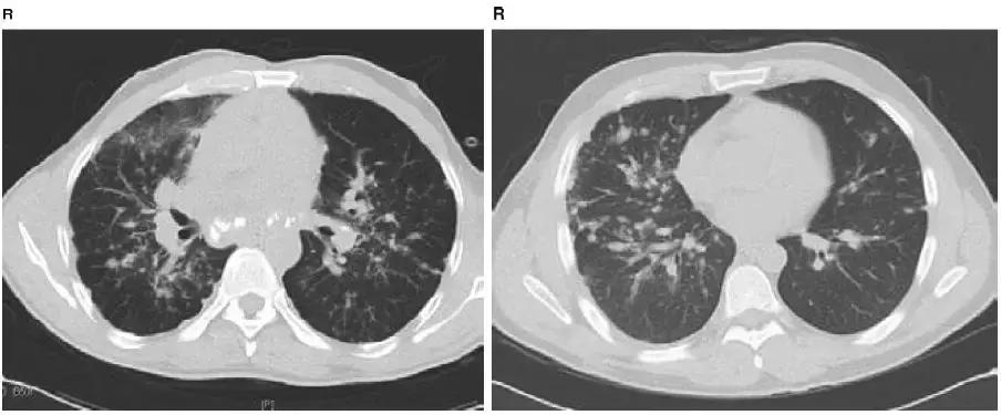 胸部影像解剖图谱书,胸部断层图谱