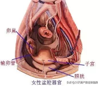 盆腔炎，讨厌你这个粘人的“小妖精”！