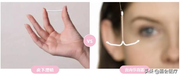 不吃药不上环怎么避孕,皮埋避孕副作用可吃药缓解吗