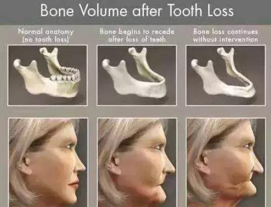 生活越来越好为什么还有烦恼,生活越来越好了快乐却越来越少了