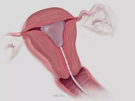 老婆生宝宝被男医生内检，老公想不通要去轻生？