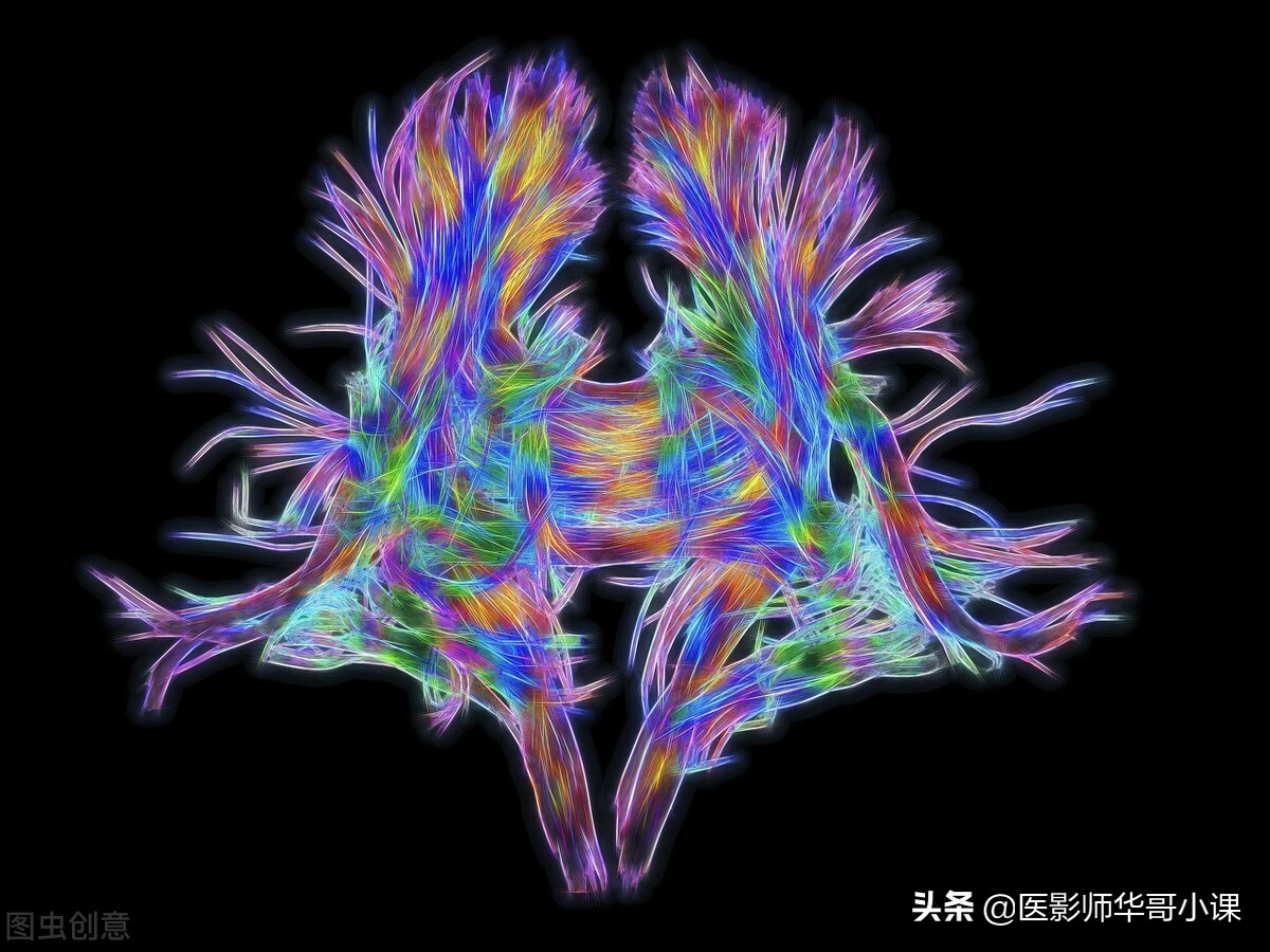 飞利浦磁共振波谱成像扫描技术,飞利浦磁共振纵隔扫描技术