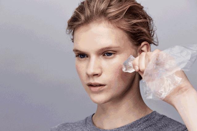 到底该不该做激光祛斑,激光点疣祛痣注意事项