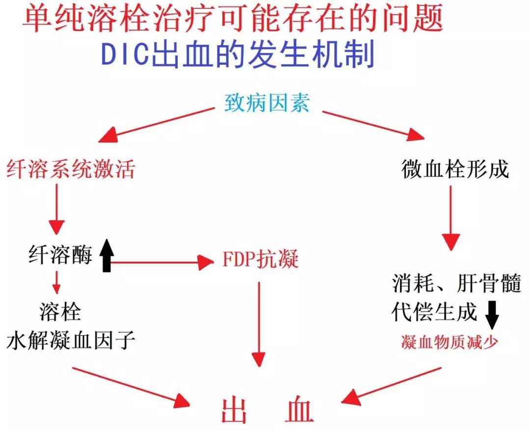 静脉血栓栓塞症发生的3个要素,静脉血栓十大抗凝误区
