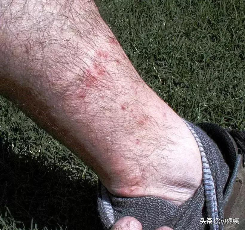 打猎高手被打脸：误把家猪当成野猪打！夏季热像仪狩猎指南