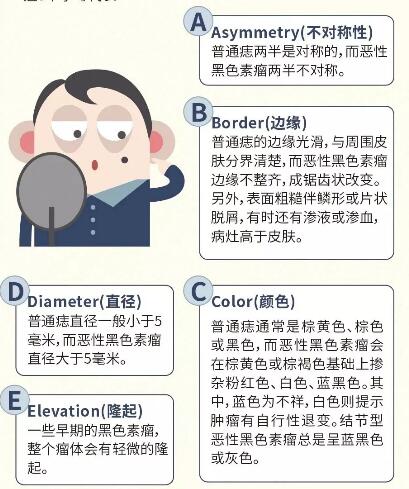 兽皮痣通过什么方式可以查出来,兽皮痣必须治疗吗