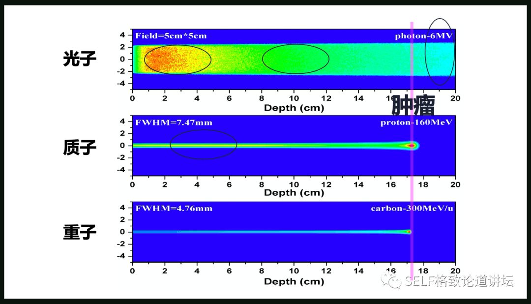 这个装置成功辅助我国两弹爆炸，现在它能治疗肿瘤