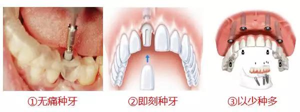缺牙真的伤不起,缺牙对你最大的影响