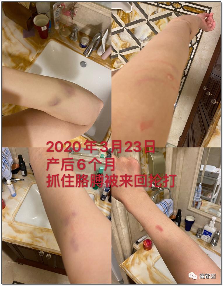 短跑名将张培萌家暴事件,短跑名将张培萌殴打岳母视频