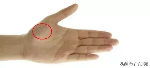 什么地方有青筋,这五个地方长痣要注意