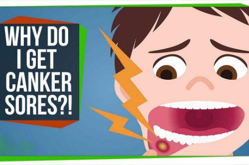 别大意！口腔溃疡老是不好，可能是大病前兆