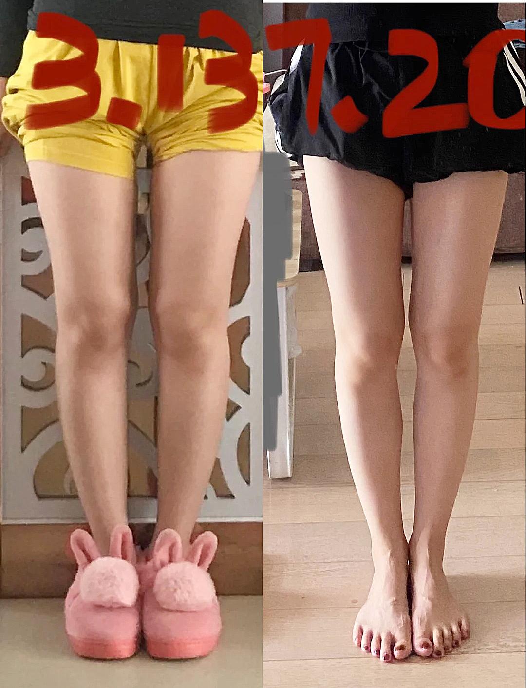 今年最流行遮肉款超显瘦,夏季露肉显瘦