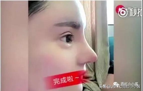 鼻子怎么修复好看呢,鼻型修复方法大全