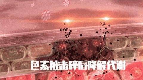 激光洗纹身出血吗,洗纹身是什么体验