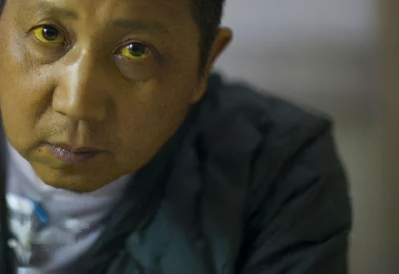 九大体质的诊断标准,什么指标诊断易栓体质