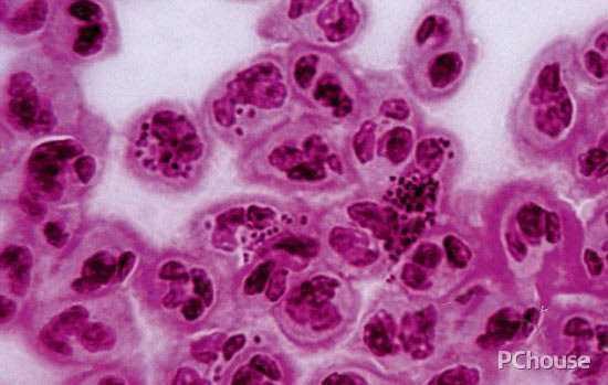 破坏人体生殖系统药物,破坏生育权触犯刑法