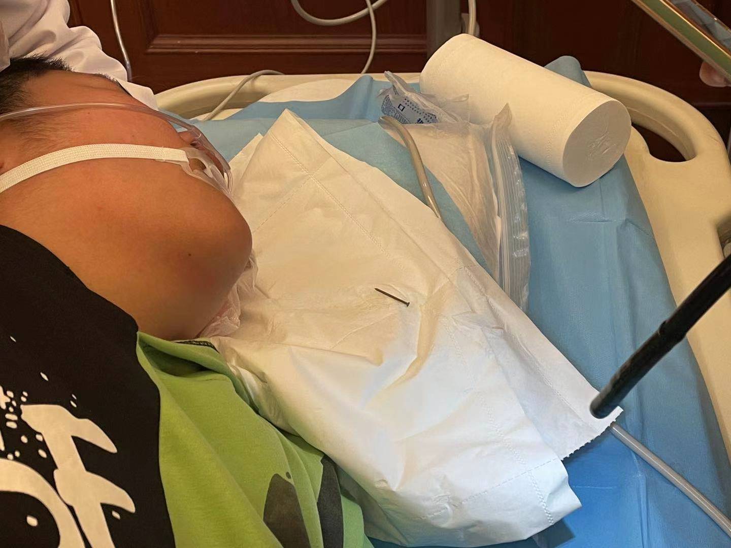 危险！长春13岁男孩把两根4厘米长钢钉含在嘴里玩不慎误吞