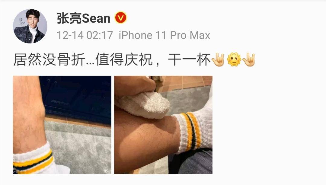 张亮晒腿受伤的视频,张亮受伤