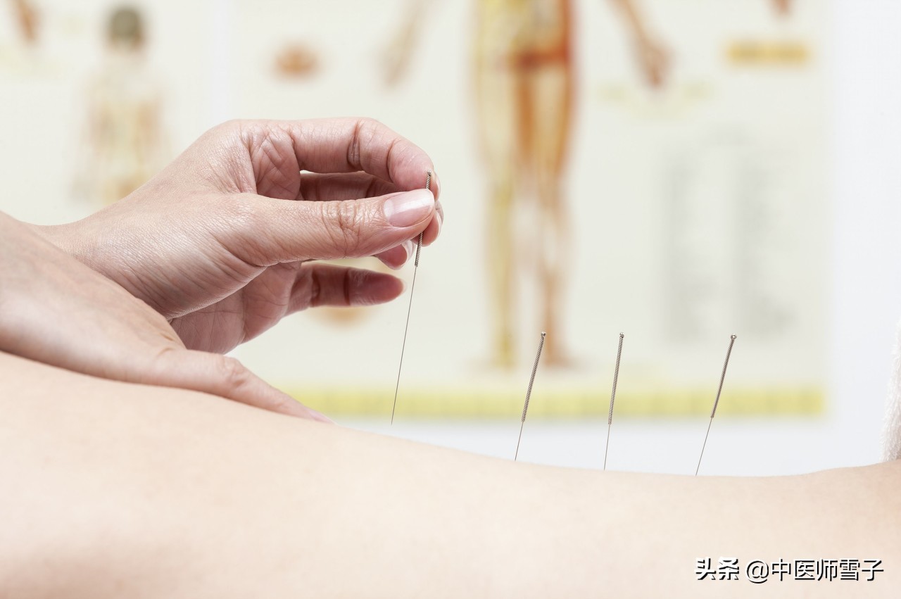 针灸拔罐祛富贵包的最快方法,富贵包针灸拔罐一次多少钱