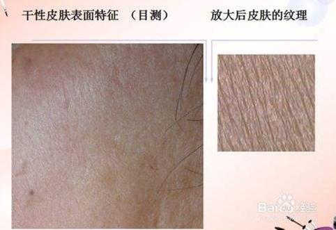 皮肤基础知识及各类皮肤护理重点,皮肤的基础医学知识及护理重点