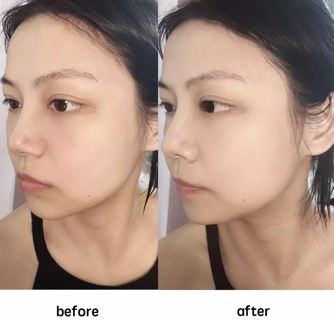 不要被面膜骗了,千万别被美容院忽悠