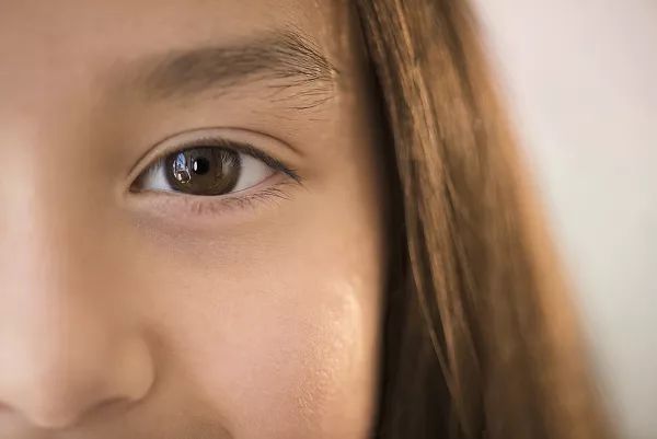 烂脸警告,这些膏求求你别再乱用啦!