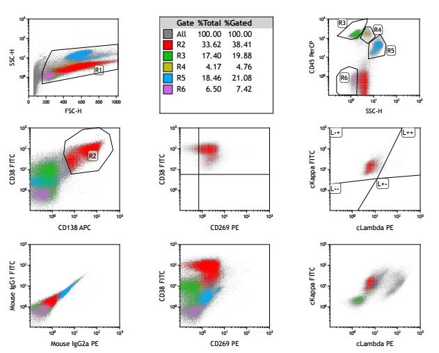 自体BCMA-CART成功治疗伴TP53基因变异及中枢神经浸润难治复发MM