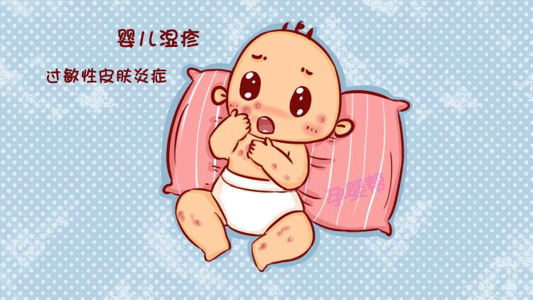 过敏宝宝身上起干性湿疹怎么办,宝宝脖子湿疹和热疹一起怎么办